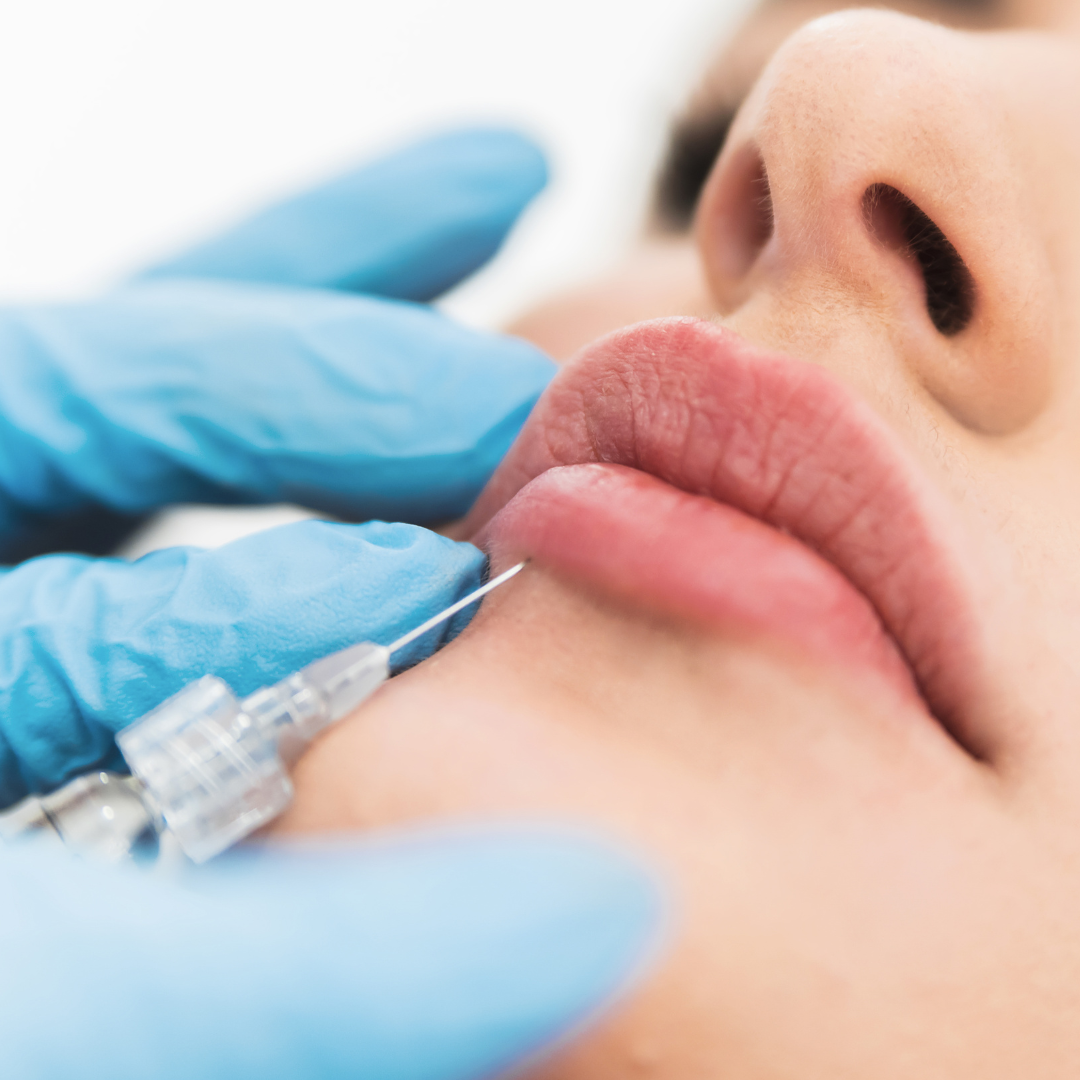 Filler Injections | Dr Shruti Kakar