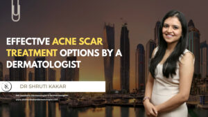 acne scar treatment, acne scar removal, microneedling