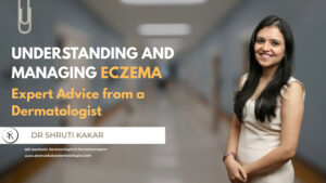 eczema treatment